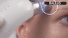 🧼 Deep Clean Pore Vacuum ✨ USB Rechargeable | Blackhead Remover Tool 💆‍♀