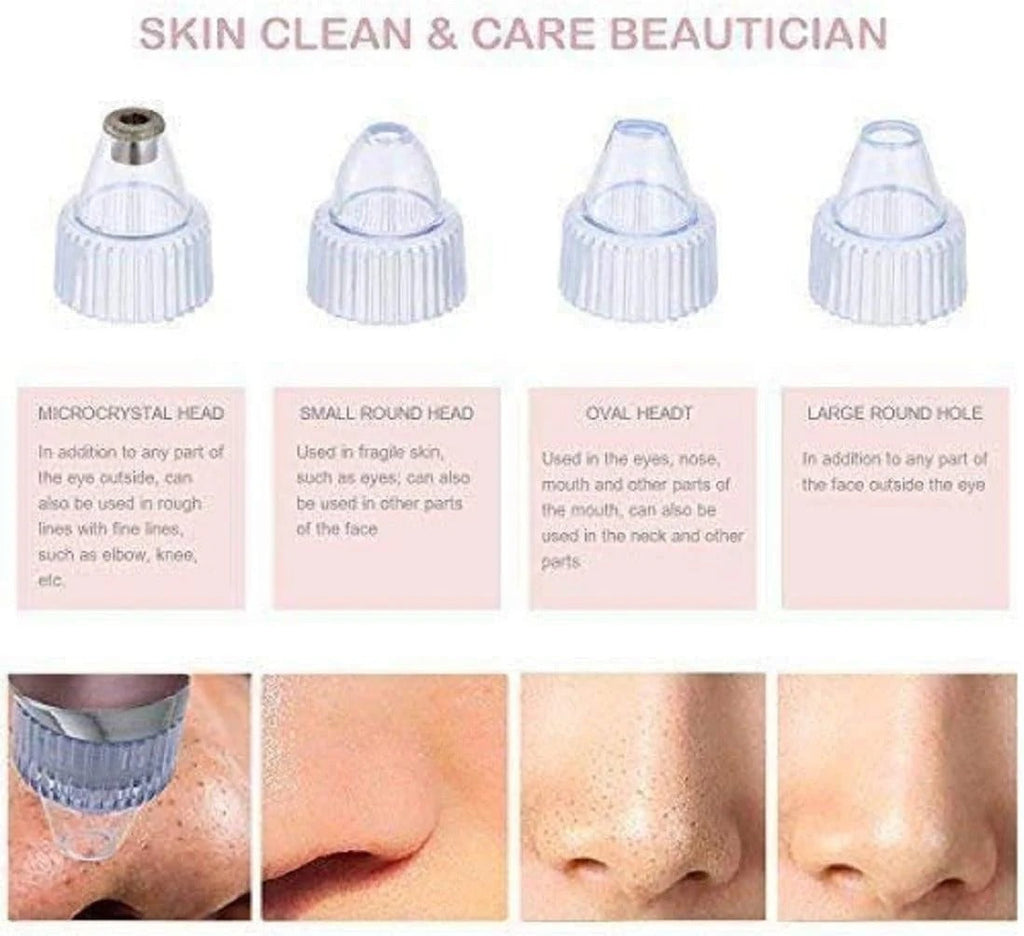 🧼 Deep Clean Pore Vacuum ✨ USB Rechargeable | Blackhead Remover Tool 💆‍♀